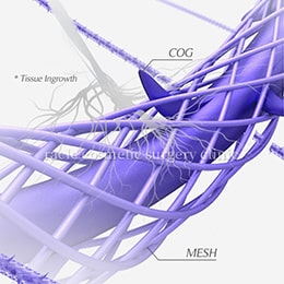 テスリフトソフトノーズの糸イメージ図