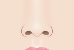 鼻の穴・小鼻の印象チェンジ　イメージ