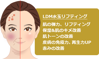 LDM水玉リフティング 効果イメージ