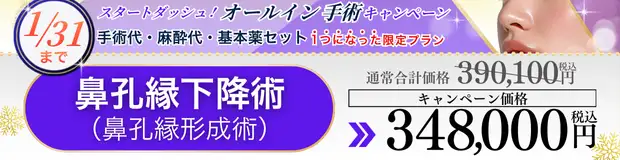 鼻孔縁下降術(鼻孔縁形成術) 全込みバナー