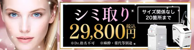 シミ取り　キャンペーンバナー