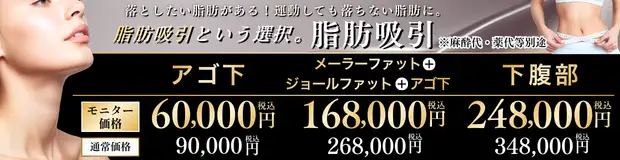 脂肪吸引のお得な料金