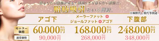 輪郭の脂肪吸引のお得な料金