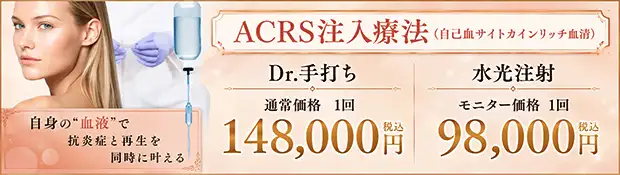ACRS注入療法のお得な料金