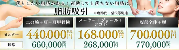 輪郭の脂肪吸引のお得な料金