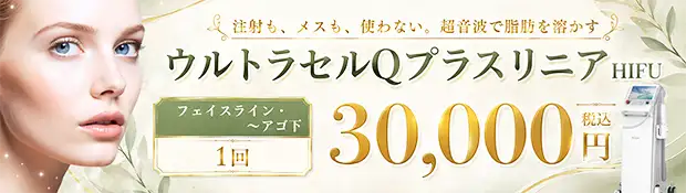 ウルトラセルQプラス リニア キャンペーンバナー