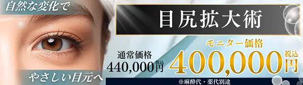 目尻拡大術　バナー