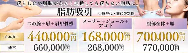 脂肪吸引のお得な料金