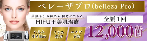 ベレーザプロ お得な料金バナー画像