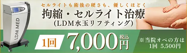 おすすめ治療バナー画像