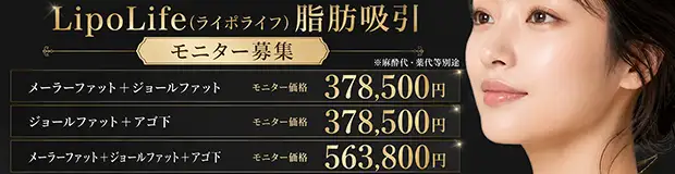 ライポライフ脂肪吸引モニター募集バナー