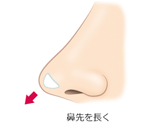 鼻先を長く イメージ