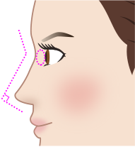 綺麗な鼻筋高さがある鼻根がくの字鼻尖が直角に近い