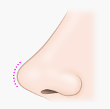 鼻尖(びせん) 鼻尖(鼻先)の形、角度